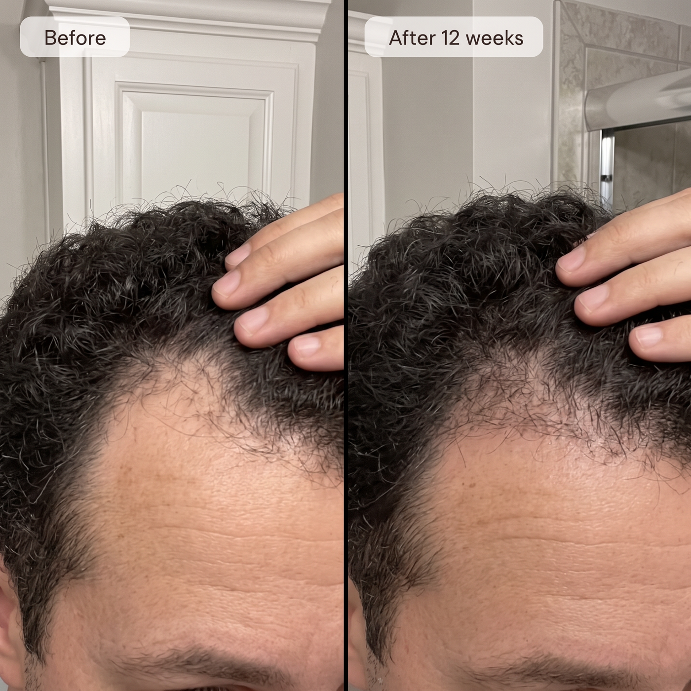 GHK-Cu Peptide & Probiotic Hair Serum