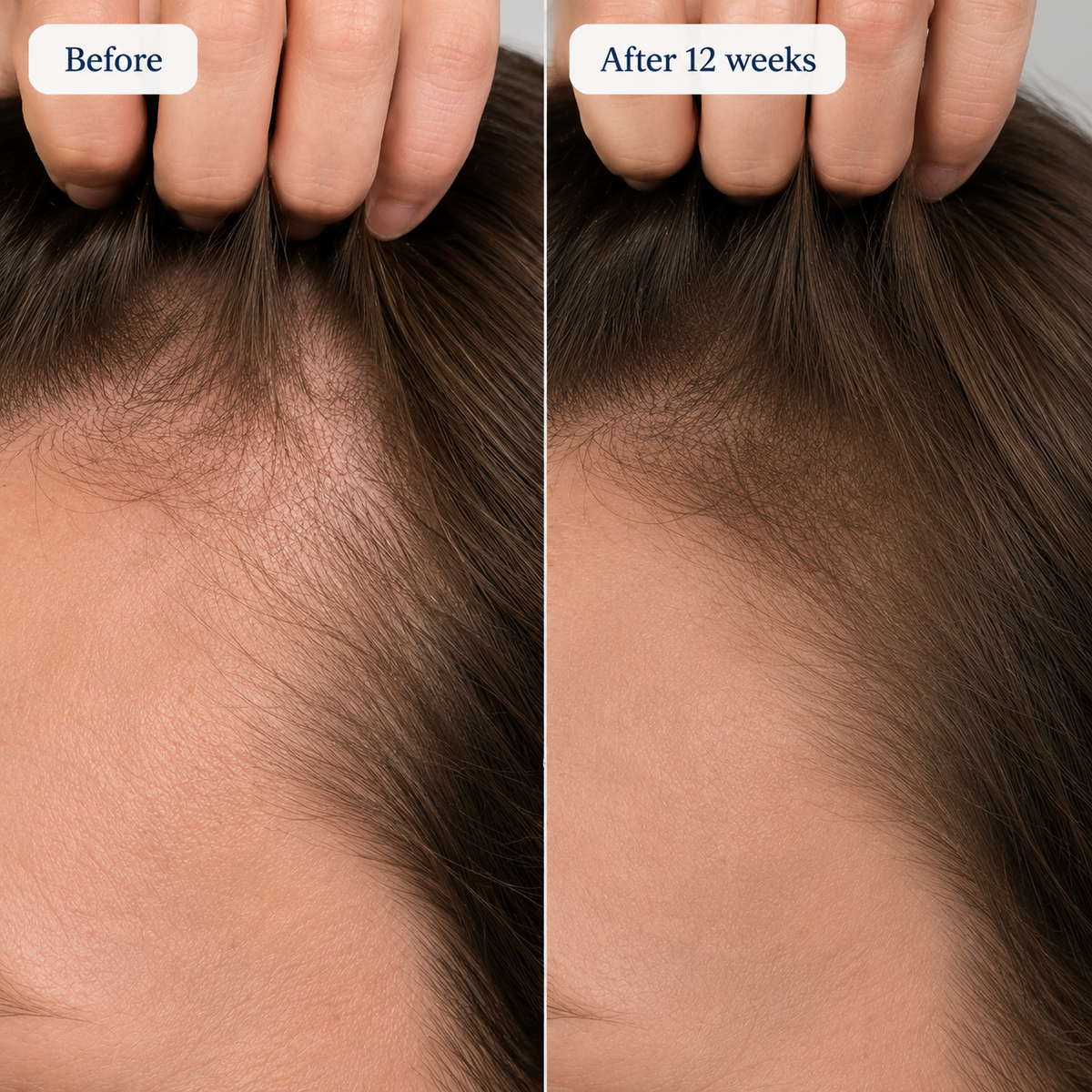 5 Reasons Your Hair Keeps Thinning at the Part Line