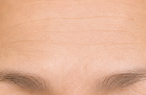 Karen B., 55